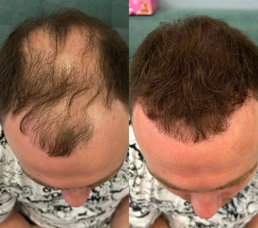 Densify Hairline and Beard Concealer — view 6