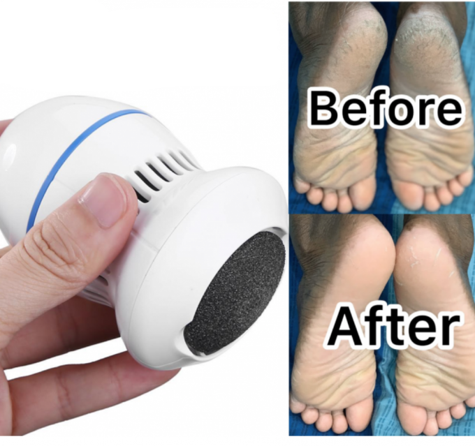 Rechargeable Electric Pedicure Tool
