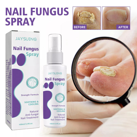 Foot and Nail Care Spray