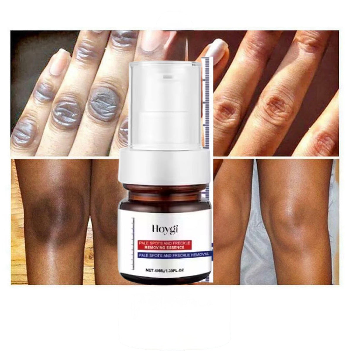 Hoygi Facial Skin Serum