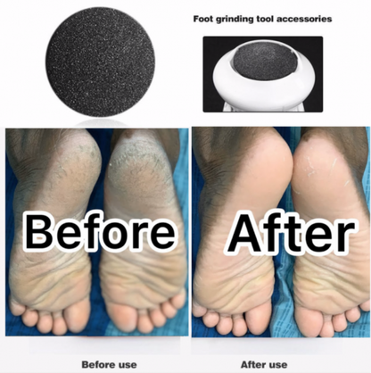 Rechargeable Electric Pedicure Tool — view 2