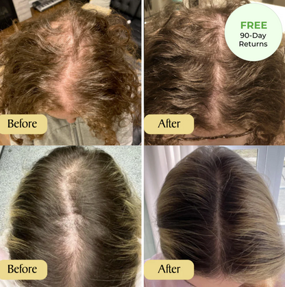 Vegan Hair and Scalp Oil — view 2