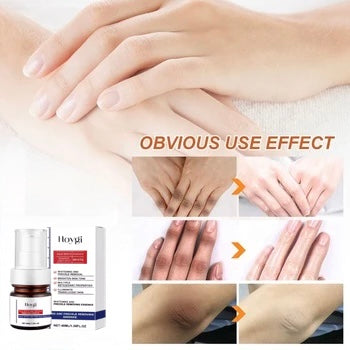Hoygi Facial Skin Serum — view 3