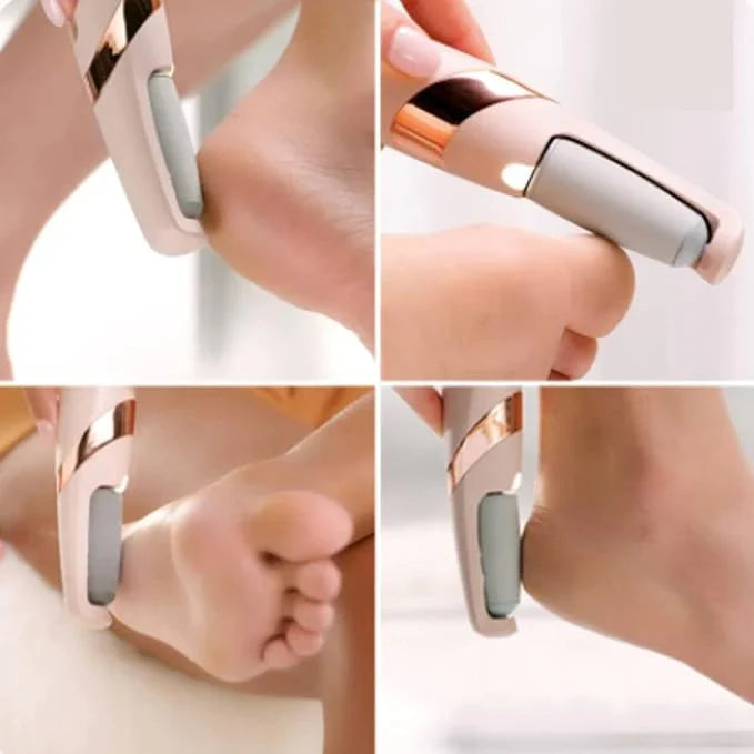Rechargeable Foot Scrubber and Callus Tool — view 6