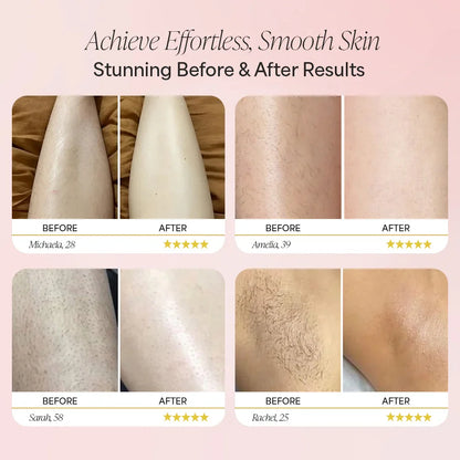 Dermave Trimmer 2.0 — view 3