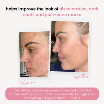 Turmeric and Kojic Acid Skincare Pads — view 3