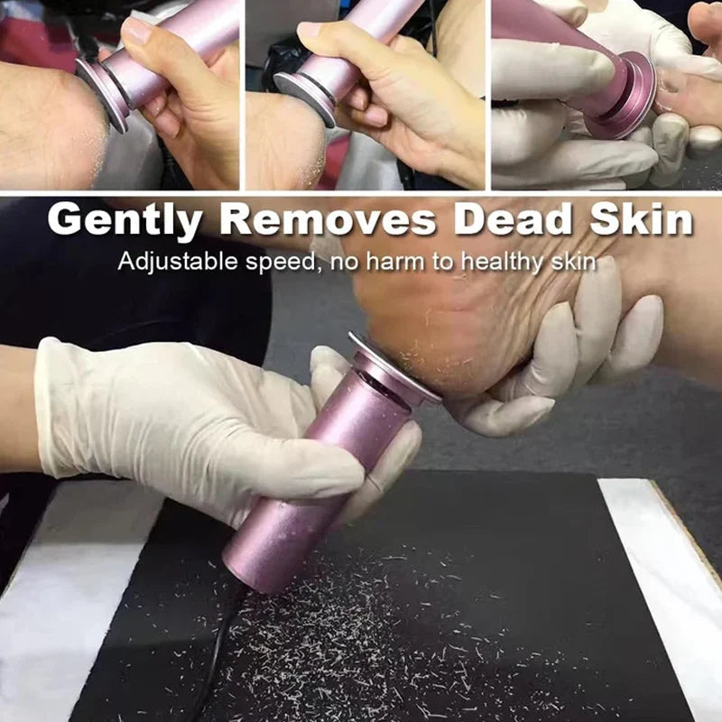 Electric Pedicure Tool — view 3