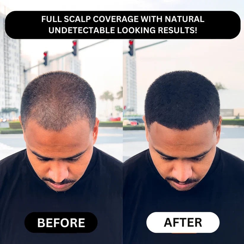 Densify Hairline and Beard Concealer — view 3