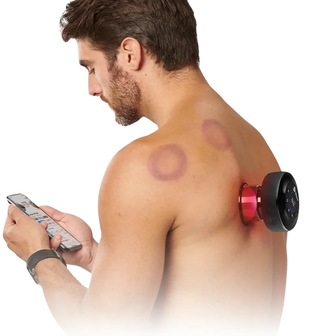 Electric Cupping Massage Tool — view 3