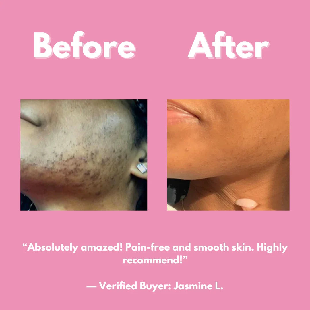 Smooth and Shine Hair Removal Kit — view 5