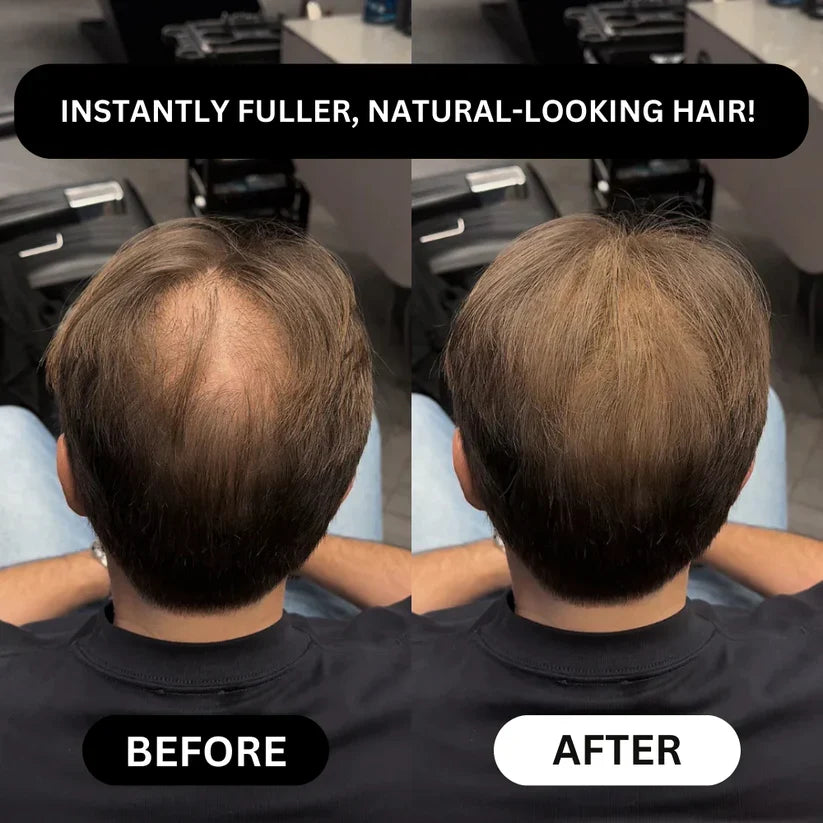 Densify Hairline and Beard Concealer — view 4