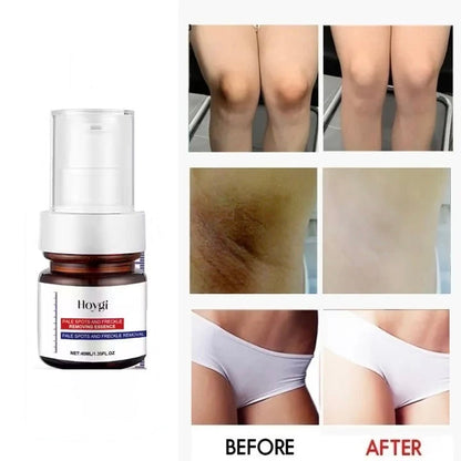 Hoygi Facial Skin Serum — view 2