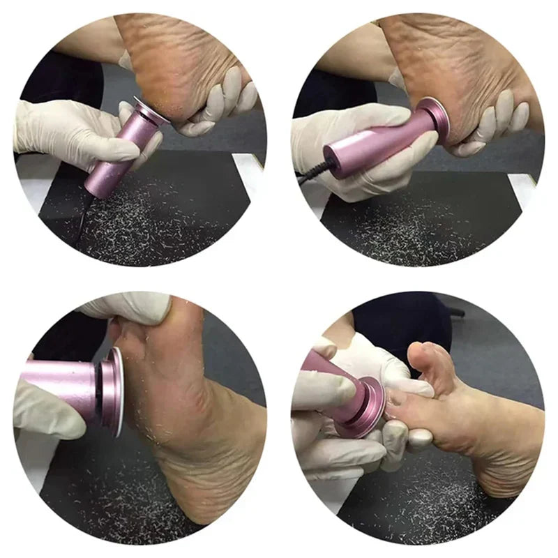 Electric Pedicure Tool — view 4