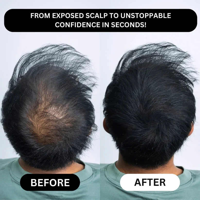 Densify Hairline and Beard Concealer — view 5