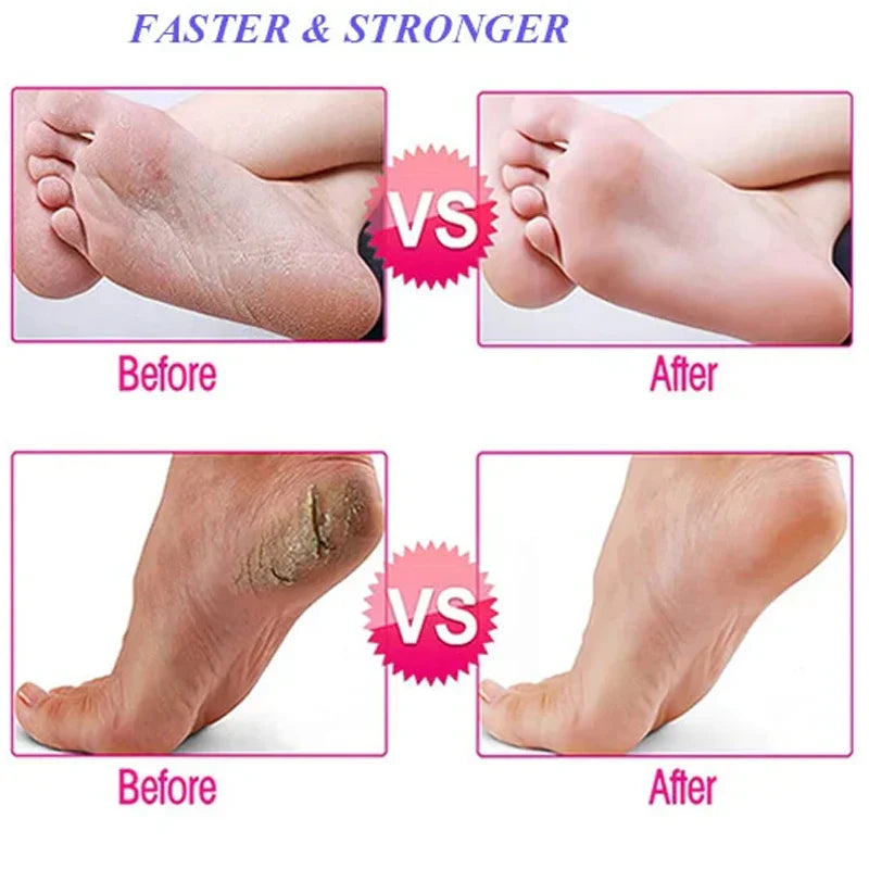 Electric Pedicure Tool — view 5