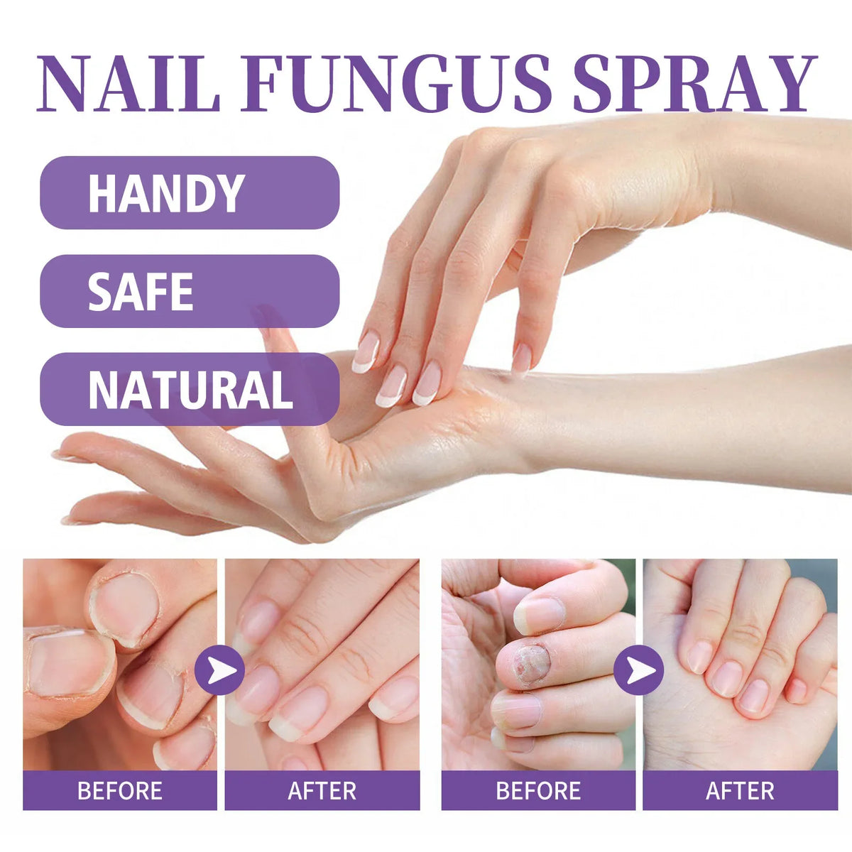 Foot and Nail Care Spray — view 5