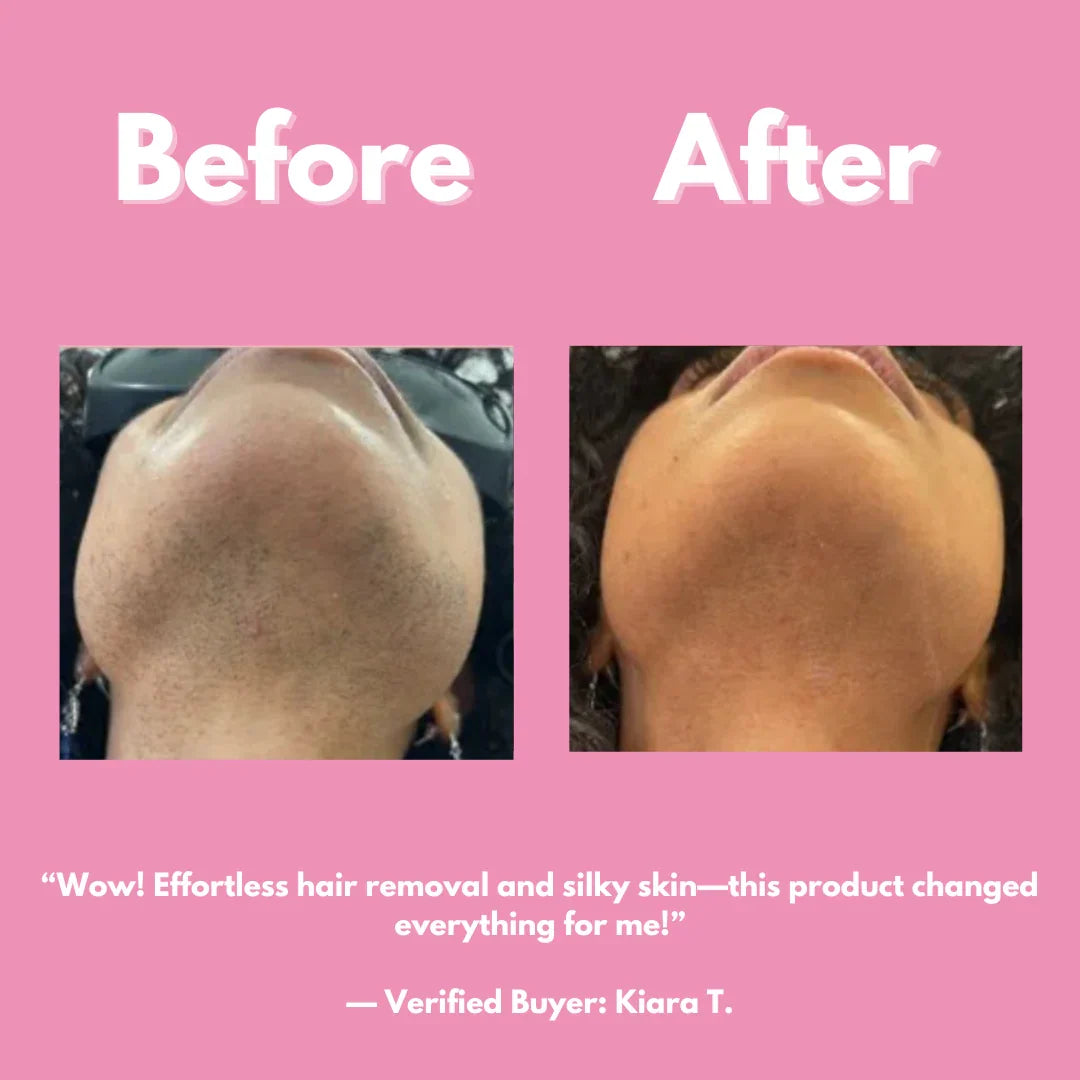 Smooth and Shine Hair Removal Kit — view 2