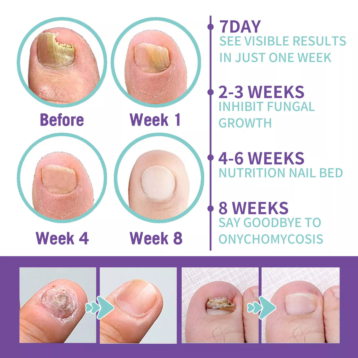 Foot and Nail Care Spray — view 6