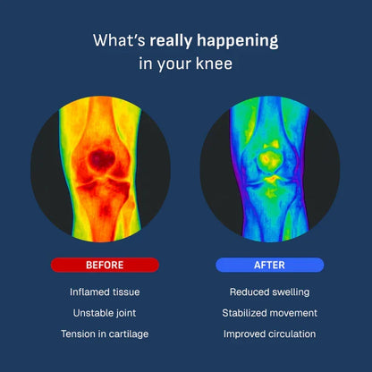 Adjustable Support Knee Brace — view 2
